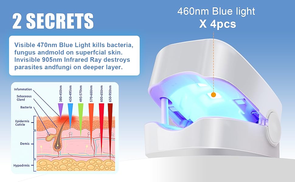 DISPOSITIVO LASER PARA ELIMINAR HONGOS